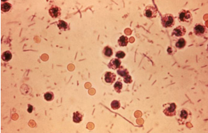 Shigella