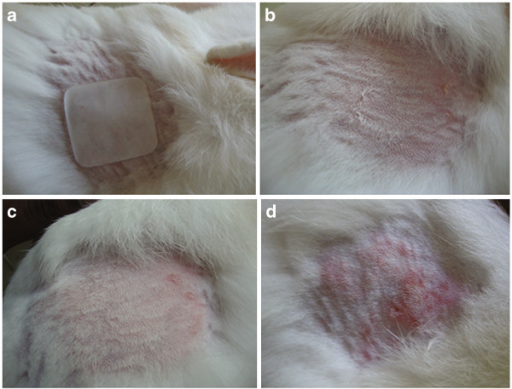 Fig.1 Images of skin irritancy study: (a) patch application to shaved area; (b) skin of rabbit at 0 day; (c) skin of test group rabbit after 7 days of patch application; (d) skin of standard group rabbit after 7 days. (Panchaxari D M, et al. 2013)