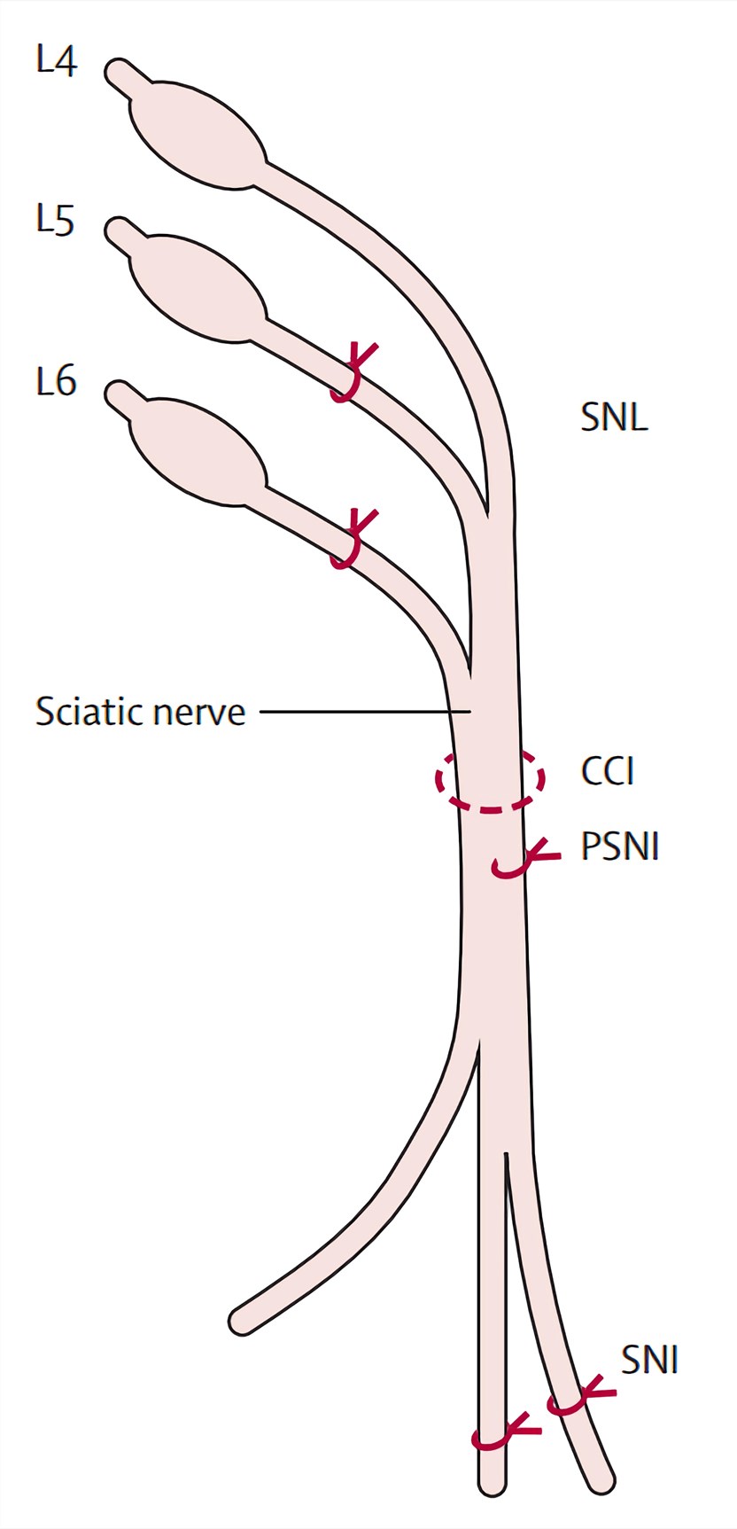 Spinal Nerve Ligation (SNL) Rat Model