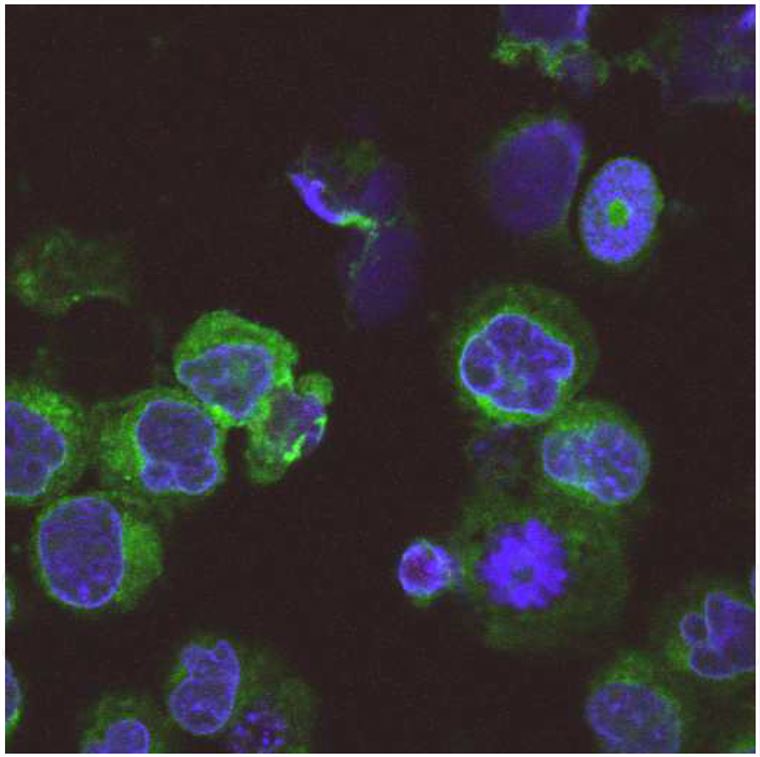 Demonstration of the sub-cellular localization of the tumor antigen SSX2IP in K562 cells using immunofluorescence microscopy.
