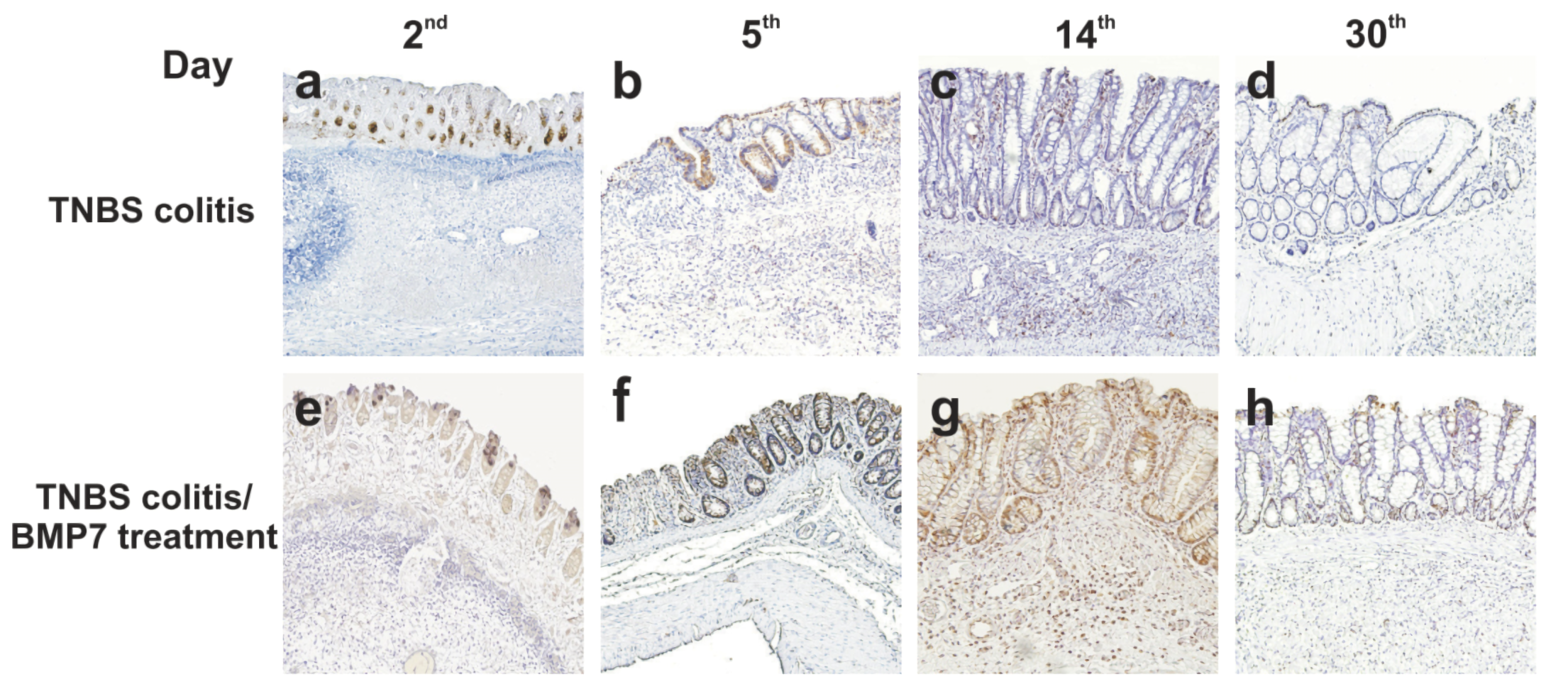 TNBS/DNBS-Induced Rodent Colitis Model