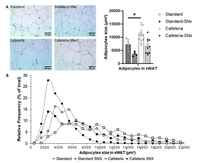 Fig. 1 Assessment of adipocyte sizes and distribution frequency.