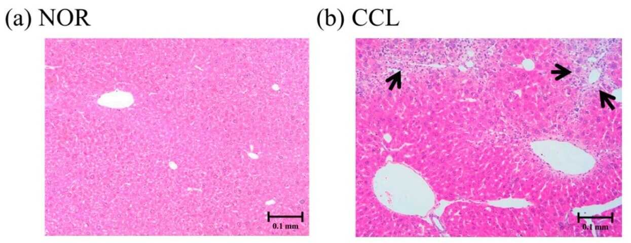 Fig. 1 The pathological images of CCl4-induced liver injury mice.
