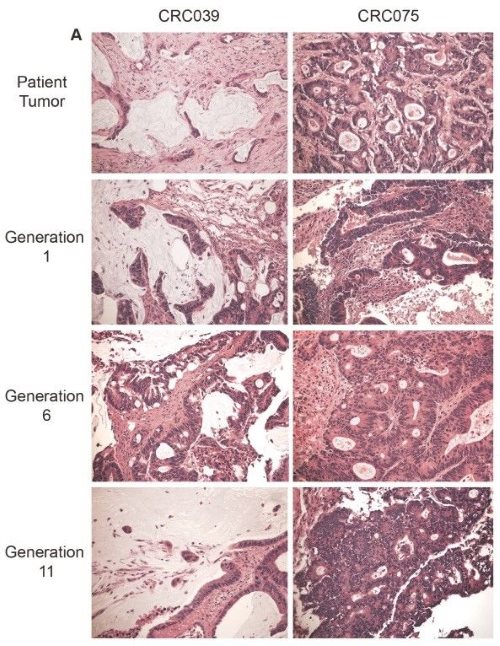 Fig. 1 PDCCE tumor pathology is retained after 11 generations in mice.