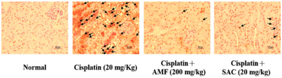 Fig. 1 Images of kidney tissue stained with TUNEL.