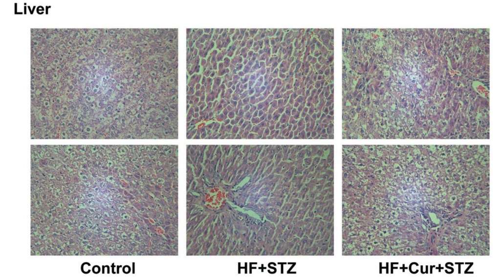 Fig. 1 The hepatic histopathological alterations in rats subjected to a high-fat diet followed by streptozotocin treatment.