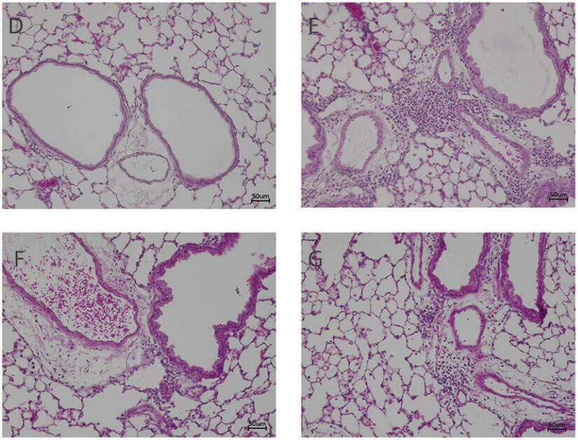 Fig. 1 Histological images of the lungs of HDM-allergic mice stained with H&E.