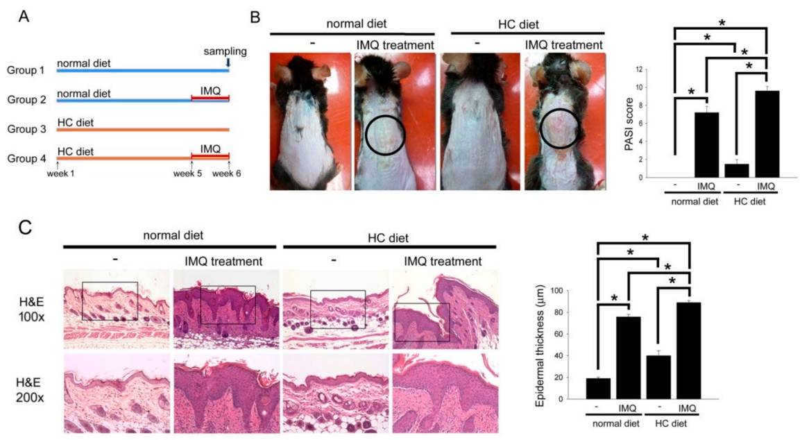 Fig. 1 The HC-diet exacerbated the psoriasis-like manifestations and epidermal hyperplasia in mice treated with IMQ.