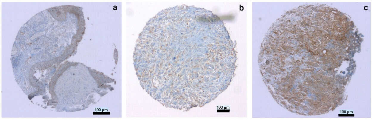 Fig. 1 Images of CD276 in tissue samples by immunohistochemistry.