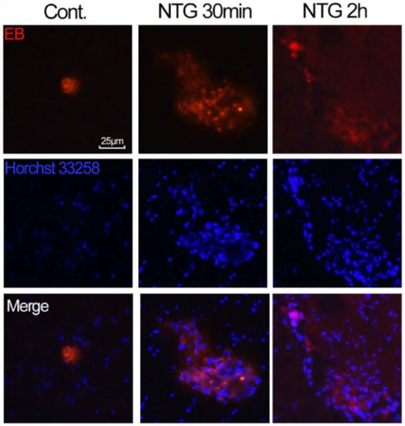 Fig. 1 Pictures of EB staining in the TNC of rats with NTG-induced migraine.