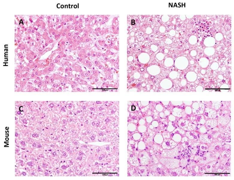 Fig. 1 Liver Histological sections of human and mouse NASH.
