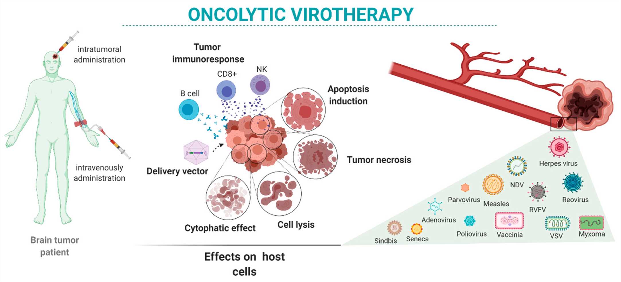 OV therapy for the treatment of brain tumors: administration routes (left), antitumor mechanisms (middle), types and characteristics of viruses (right).