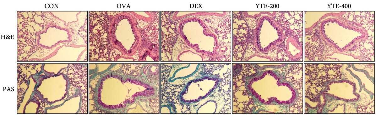 Fig. 1 Lung histology images of ovalbumin-induced asthma mice