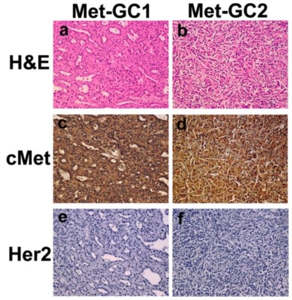 Fig. 1 H&E and immunohistochemical staining images of the PDTX models of gastric cancer.