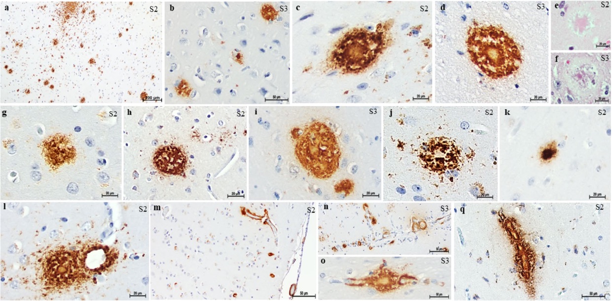 Fig. 1 Images showing β-amyloid pathology in capuchins.