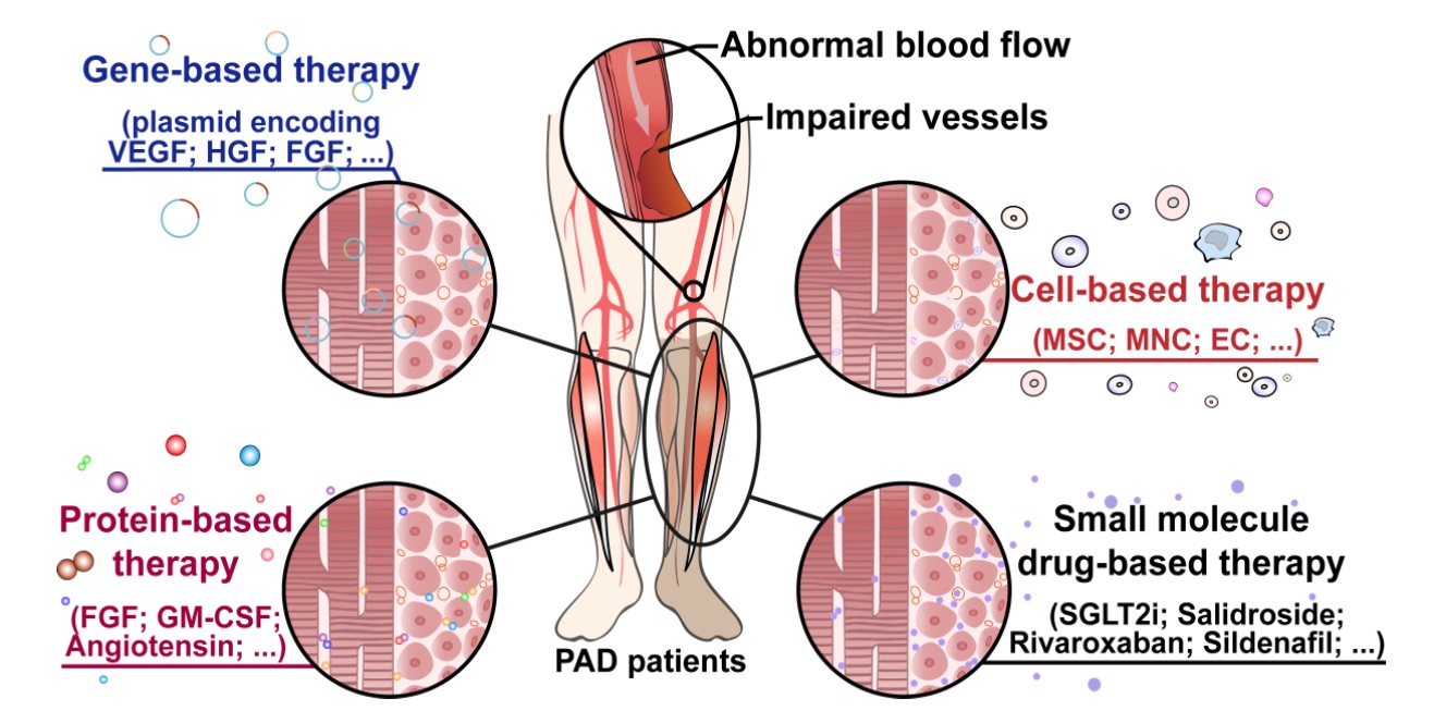 Fig. 1 Images showing therapeutic angiogenesis-based strategy for peripheral artery disease.