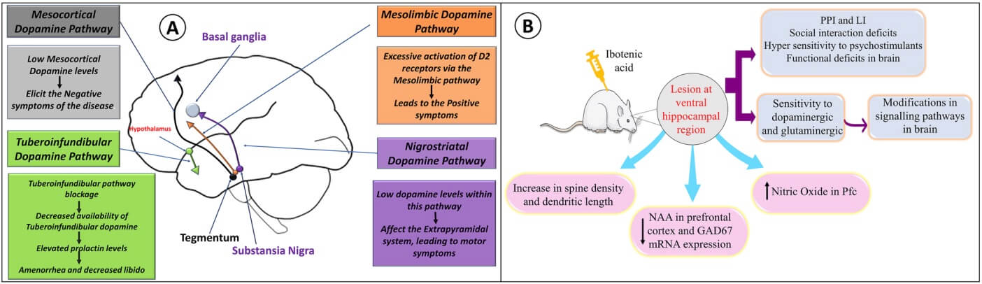Fig. 1 A Pathophysiological image of schizophrenia according to dopamine hypothesis, B Depicts amphetamine associated morphological and behavioral changes in mesolimbic pathway of brain.