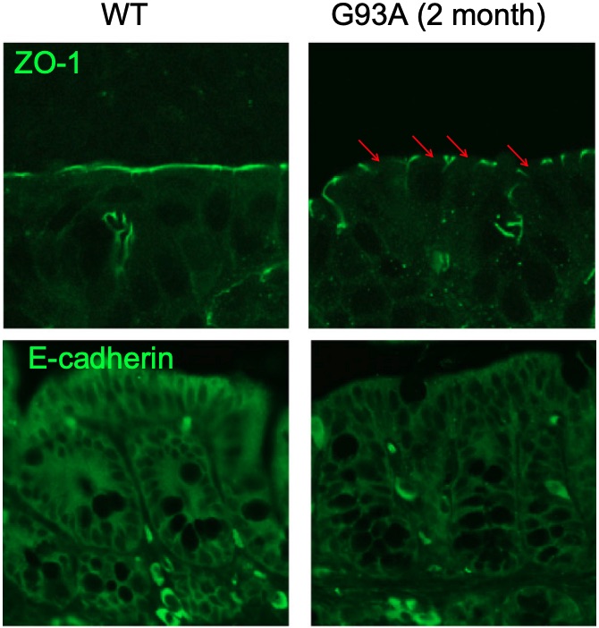 Fig. 1 Immunostaining pictures of ZO-1 and E-cadherin in the colon of ALS model mice.