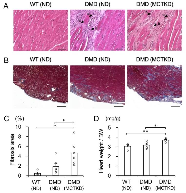 Fig. 1 Histopathological results of left ventricular tissues from DMD rats.