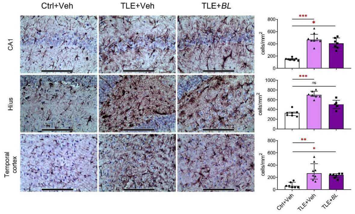 Fig. 1 Images of astroglial density in CA1, hilus, and temporal cortex from lithium–pilocarpine induced TLE rats.