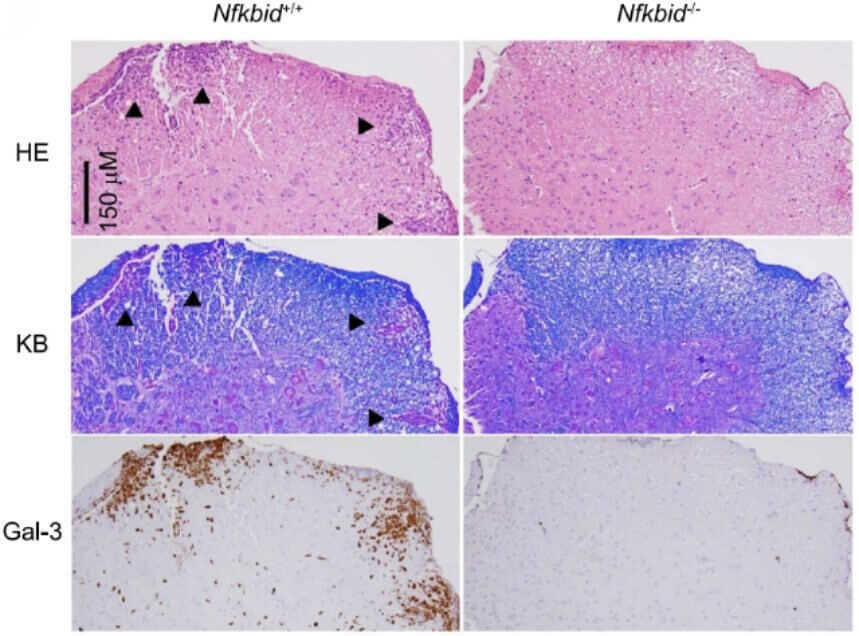 Fig. 1 Histopathological pictures of spinal cord specimens in EAE mice models.