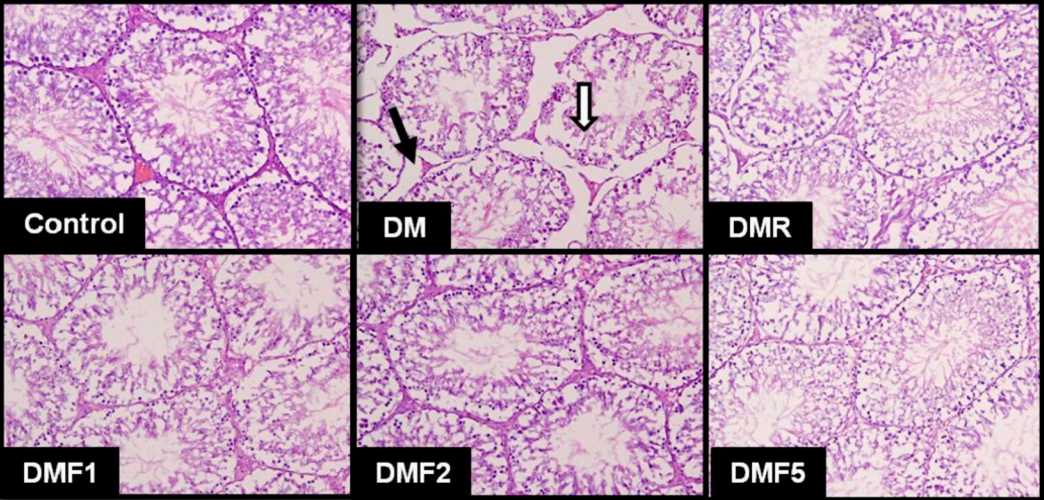 Fig. 1 Effects of fucoxanthin on testicular morphology in a rat diabetes model induced by streptozotocin and nicotinamide.