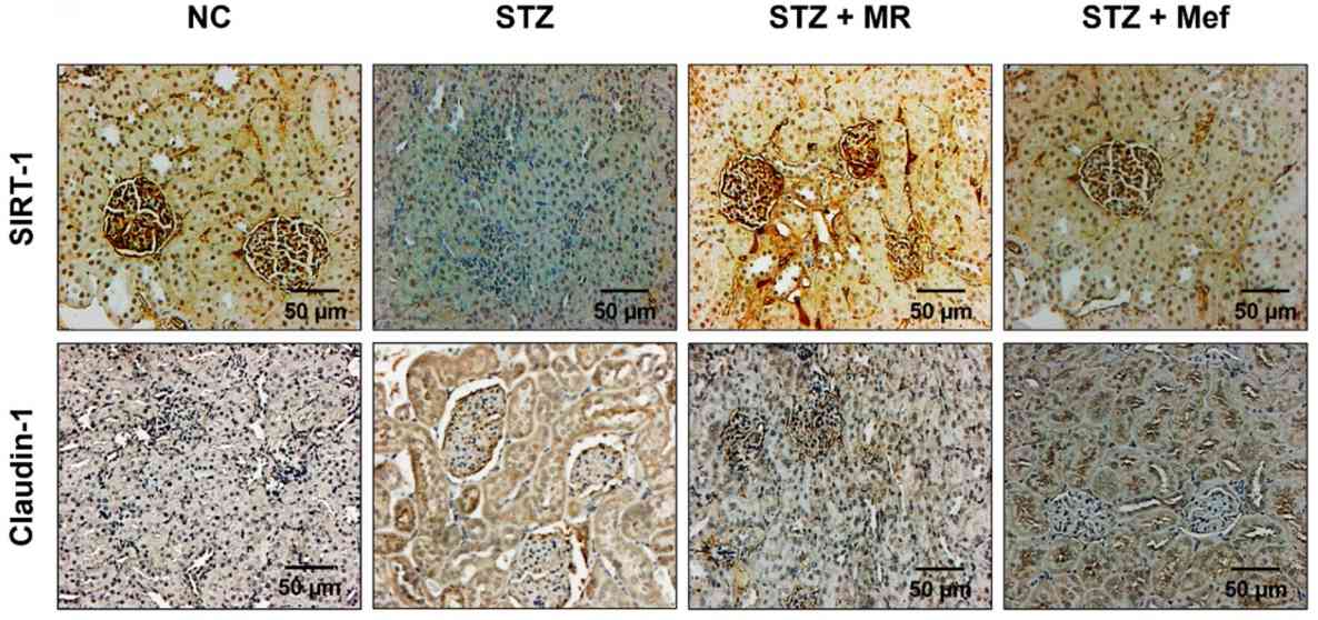 Fig. 1 Immunohistochemical analysis of mice with streptozotocin-induced diabetes.