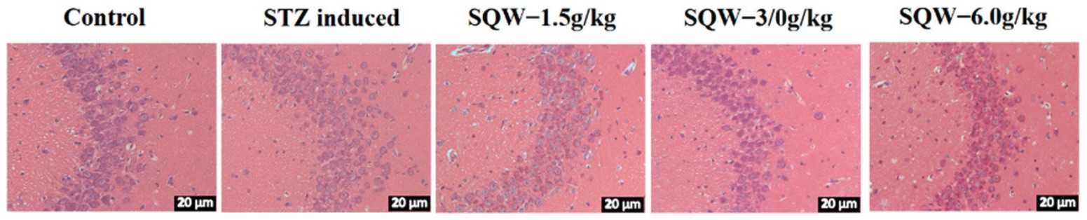 Fig. 1 Pictures of the hippocampus induced by STZ in rats