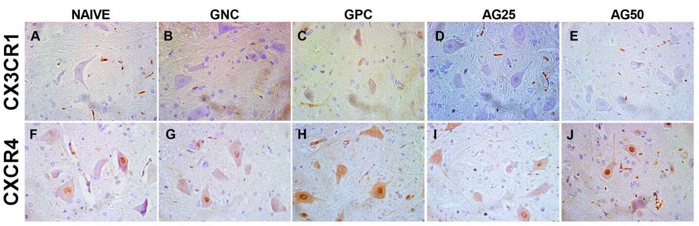Fig. 1 Pictures of immunostaining expression in rat spinal cord of CX3CR1 and CXCR4.