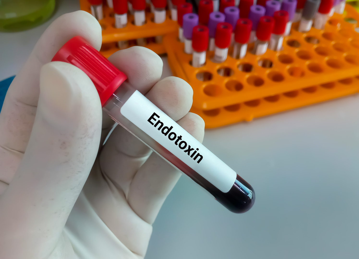 Specialized endotoxin testing kit for dialysis fluids and complex biologics