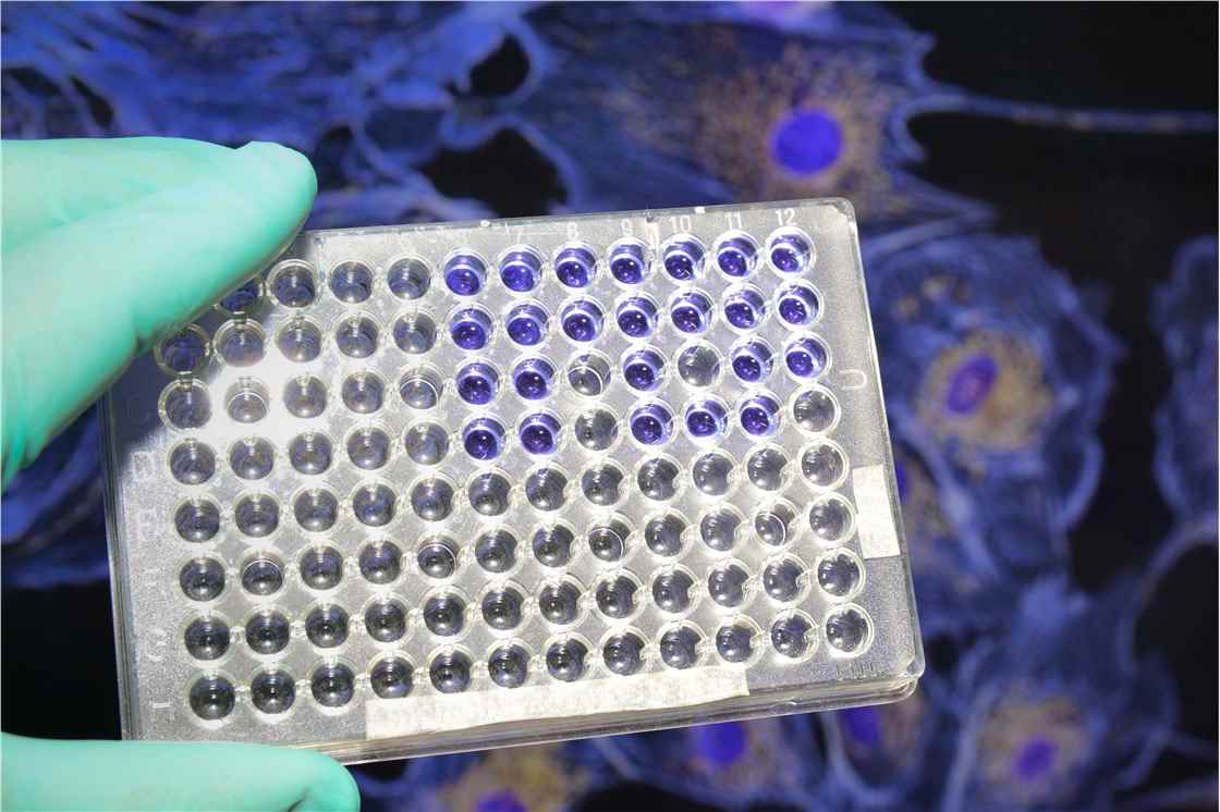 Endotoxin Testing Consumables (Creative Biolabs Authorized)