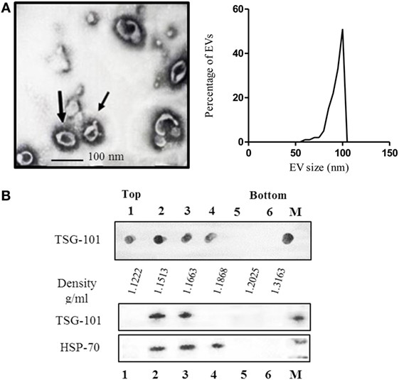 Fig.1 Ascites EV characterization.