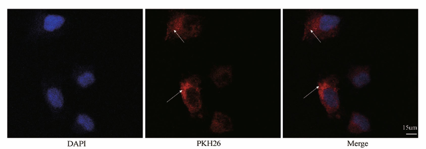 PKH26-labeled Exos (red) and DAPI (blue). Arrows indicate Exos.