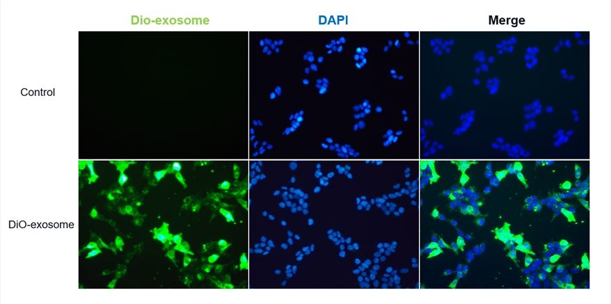 DiO-labeled exosomes were uptaked by HEK 293T cells. (Creative Biolabs Original)