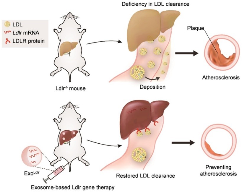 Ldlr mRNA in exosomes reverses the phenotype. (Li, et al., 2021)