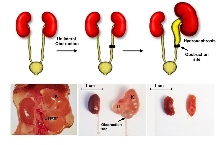 Schema of generation of the Unilateral ureteral obstruction (UUO) model.