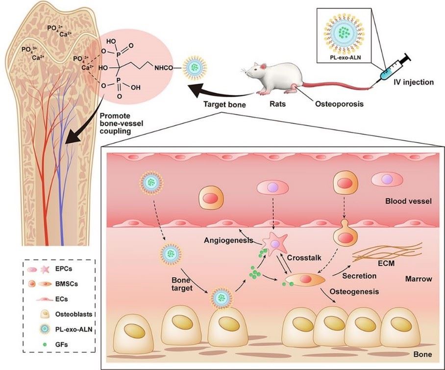 Platelet lysates-derived exosomes and alendronate preparation. (Zheng, et al., 2022)