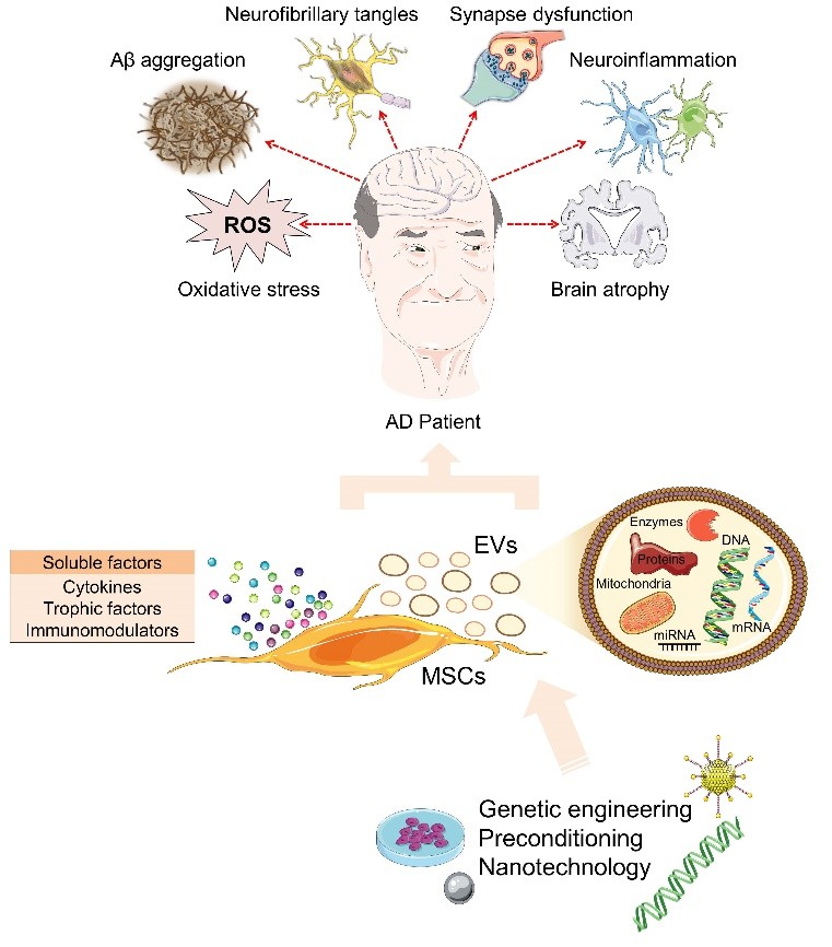 Therapeutic role of mesenchymal stem cells (MSCs) and their extracellular vesicles (EVs) in Alzheimer´s disease (AD).