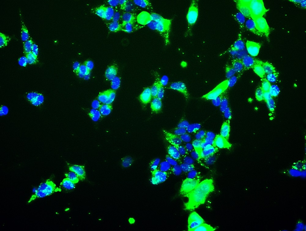 Receptor cell uptake assay. (Creative Biolabs Original)