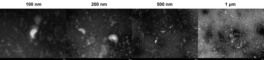 TEM results of exosomes. (Creative Biolabs Original)