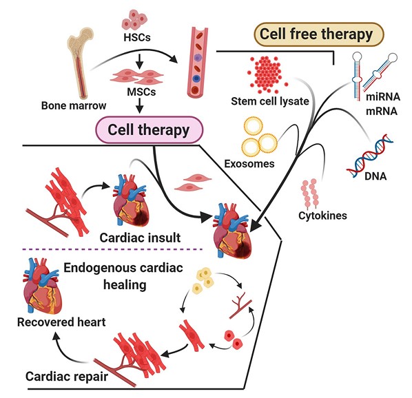 Fig.1 Comparison of cell therapy and cell-free therapy. (Jayaraman, et al., 2021)