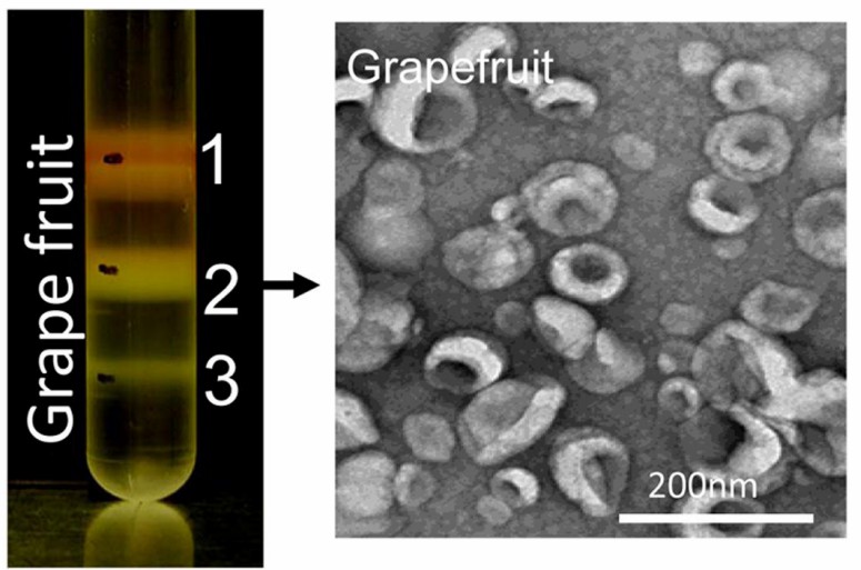 Transmission electron microscopy detection of isolated grapefruit-derived exosomes. (Wang, et al., 2014)