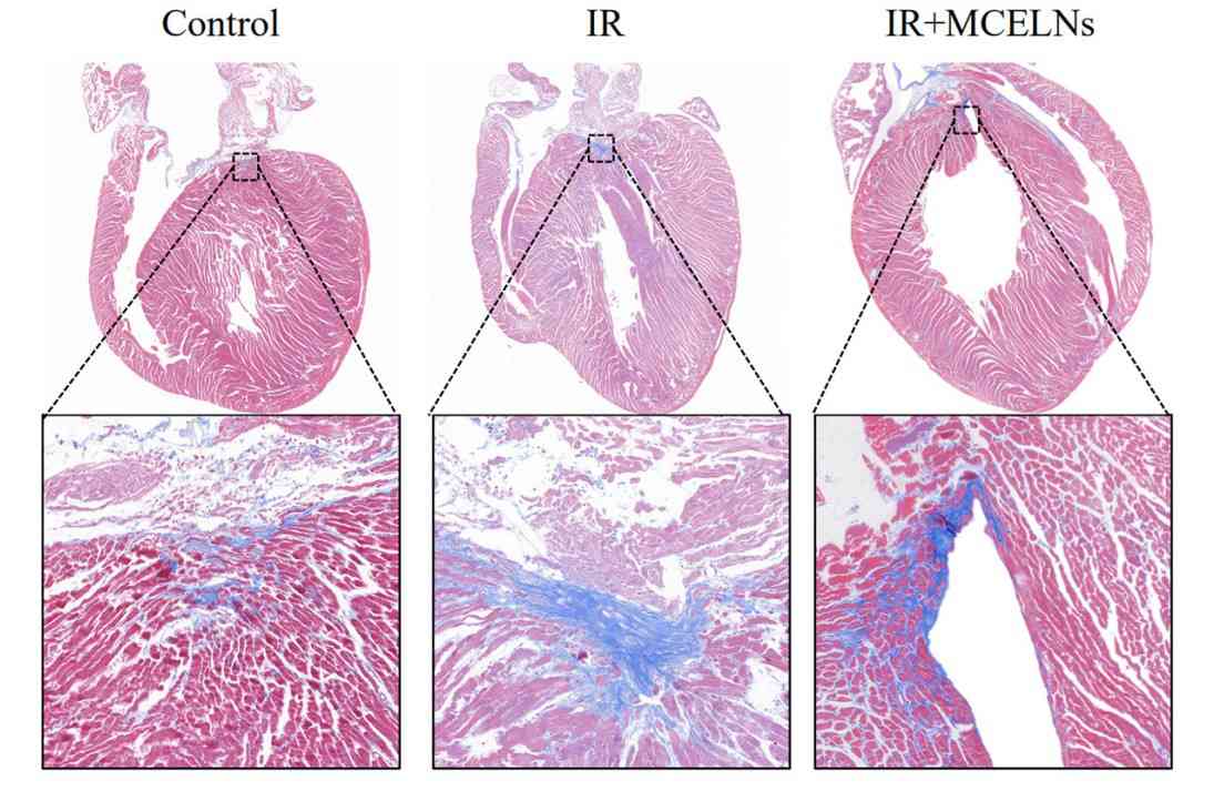 Masson trichrome staining to analyze the heart fibrosis area in mice. (Cui, et al., 2022)