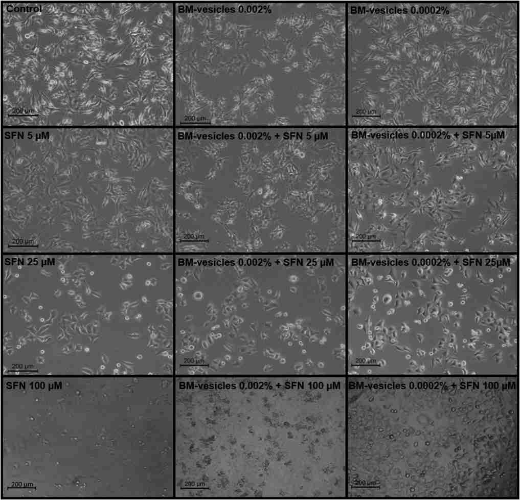Phase-contrast microscopy images of SK-MEL-28 cells treated with different treatments. (Yepes-Molina, 2021)