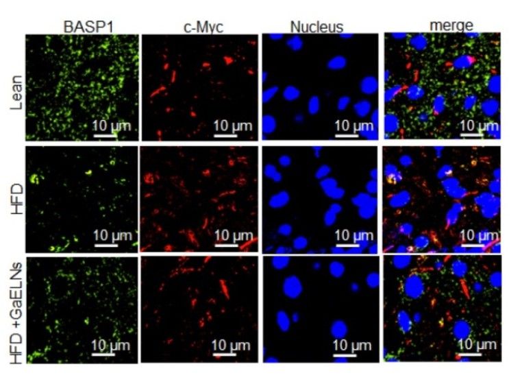 BASP1 and c-Myc staining in HFD-fed mice treated with garlic-derived exosomes. (Sundaram, et al., 2022)