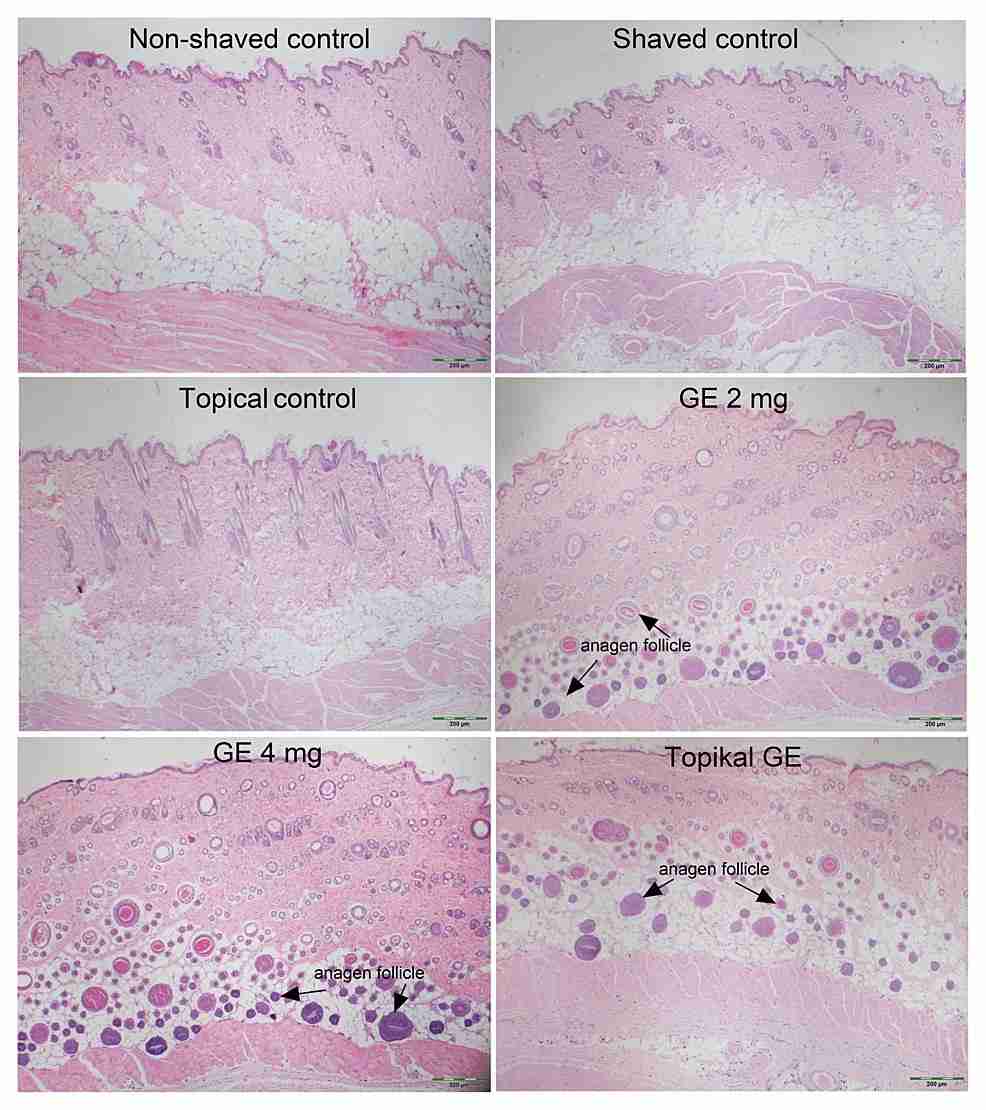 The effects of garlic-derived exosomes on hair follicles were evaluated through rat back skin histology. (Inan, et al., 2023)