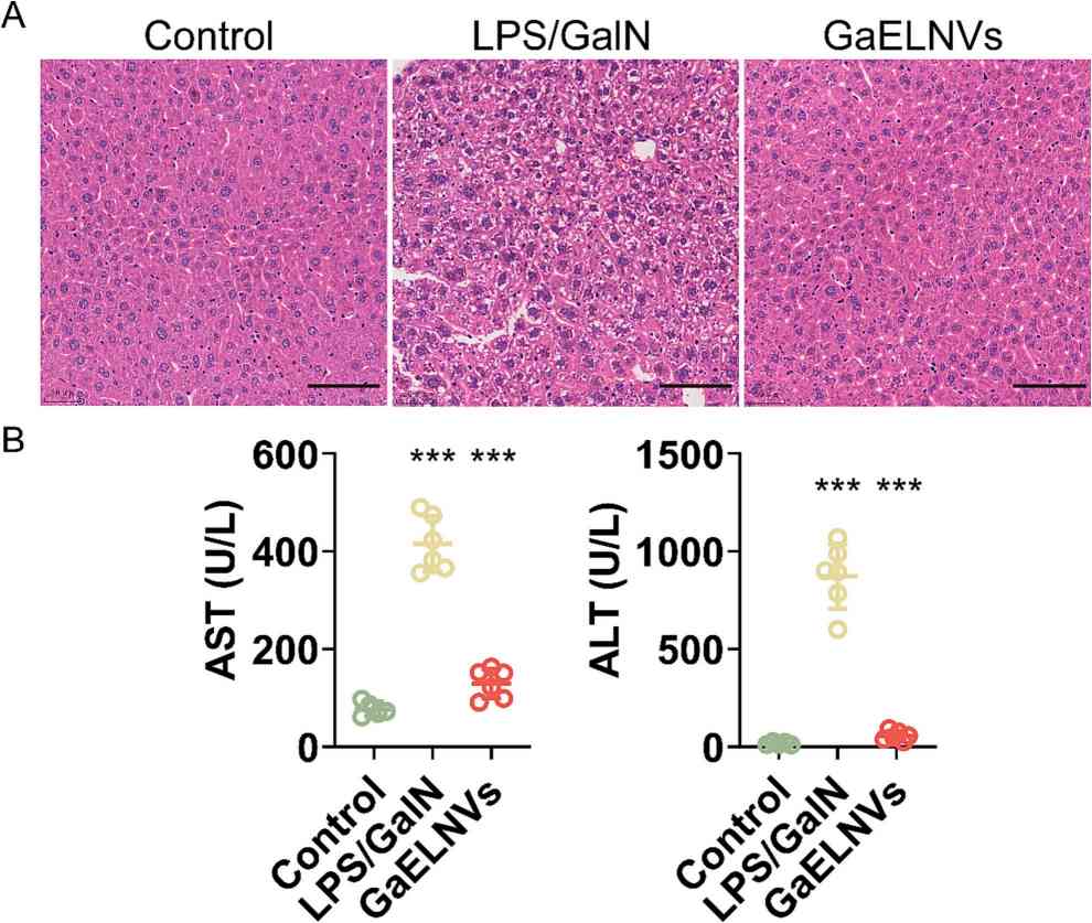 Garlic-derived exosomes alleviated the liver injury induced by LPS/D-GalN in ALF mice.(Zhao, et al., 2023)
