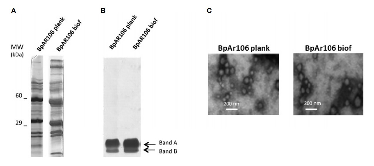 SDS-PAGE of B. pertussis-derived OMVs. (Carriquiriborde, et al., 2021)