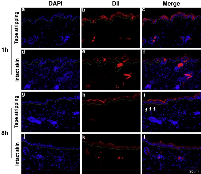 Fluorescence micrographs of Malassezia-derived exosomes penetrating into mouse epidermis. (Zhang, et al., 2019)
