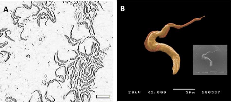 Fig.2 Trypomastigote forms of Trypanosoma brucei brucei. (Dias-Guerreiro, et al. 2021)